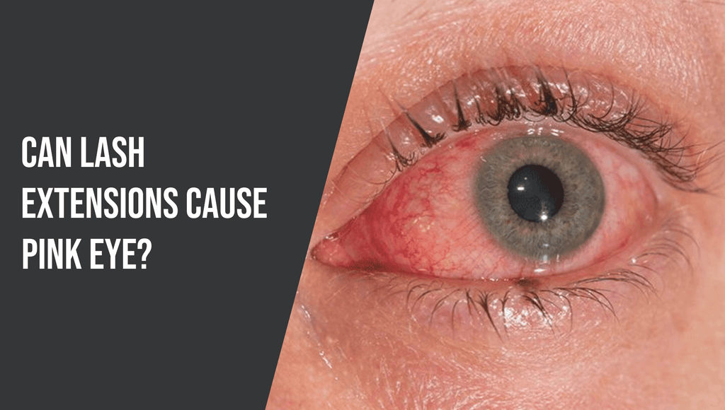 Can Lash Extensions Cause Pink Eye?