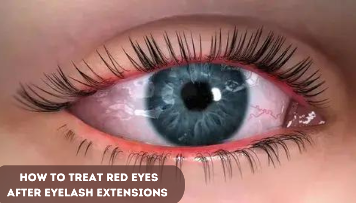 how-to-treat-red-eyes-after-eyelash-extensions