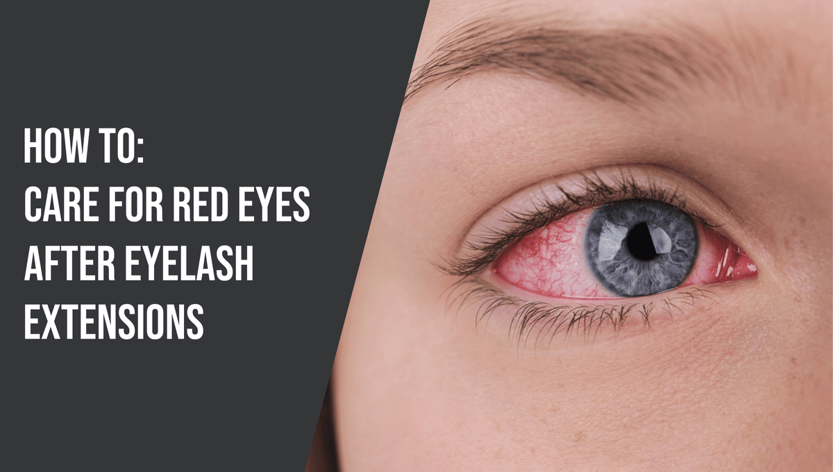 How to Care for Red Eyes After Eyelash Extensions | The Lash Professional
