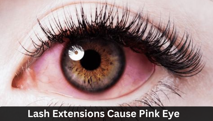 Can Lash Extensions Cause Pink Eye?