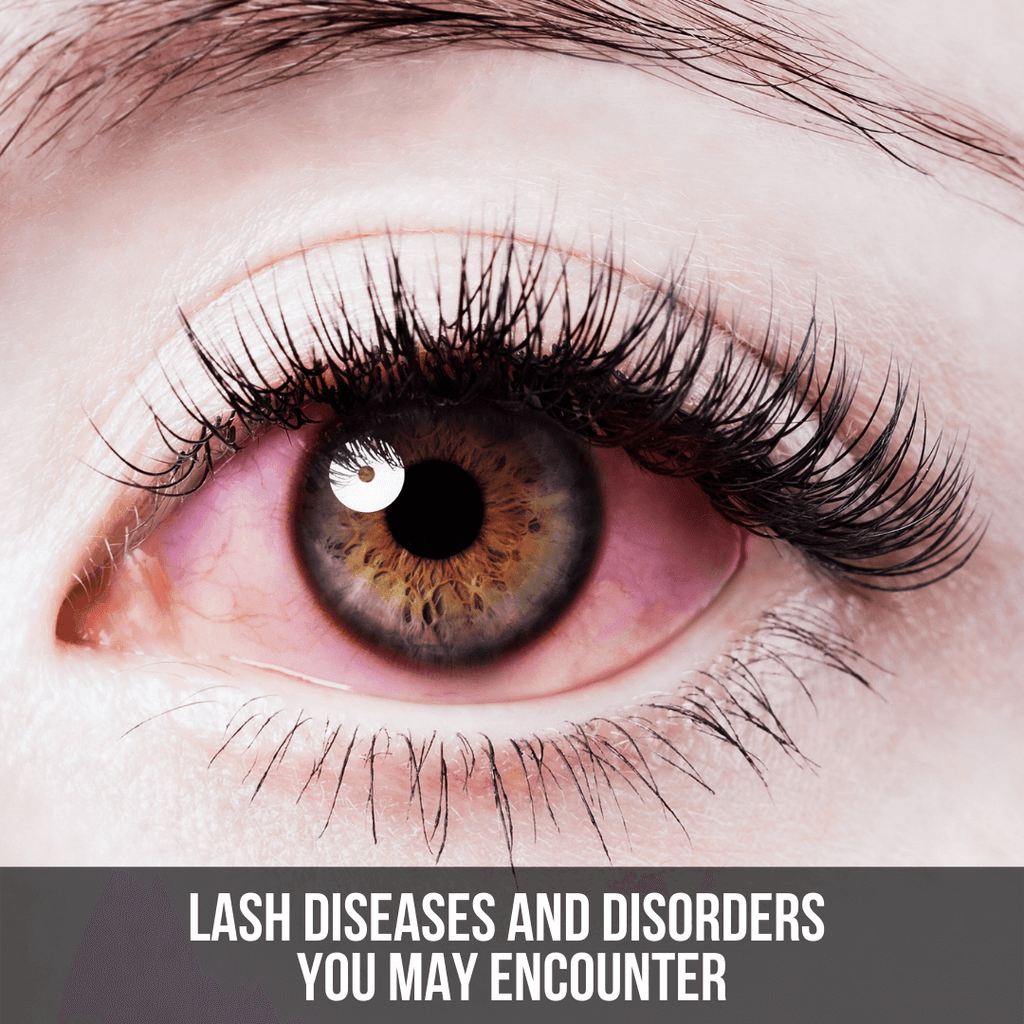 Lash Diseases and Disorders - The Lash Professional