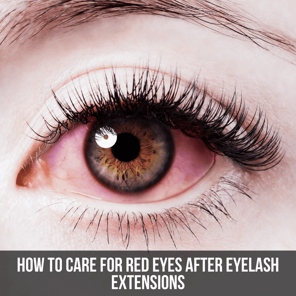 How to Care for Red Eyes After Eyelash Extensions - The Lash Professional